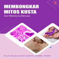 MEMBONGKAR MITOS KUSTA:  Dari Mikroba ke Manusia